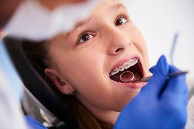 Qual a importância do aparelho dental?