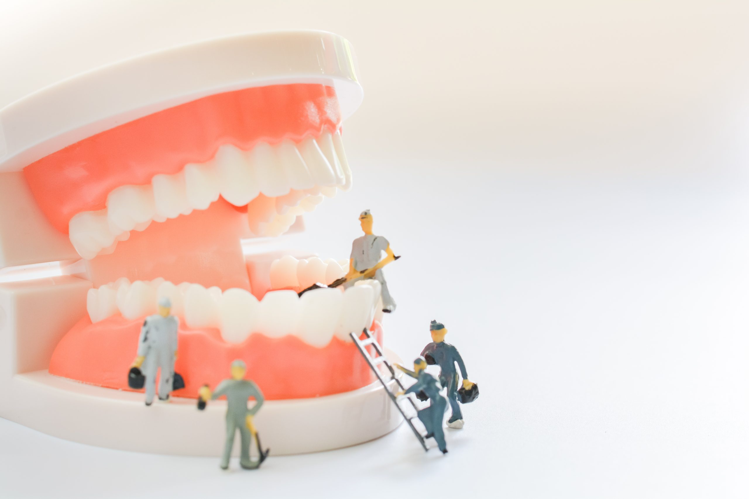 Por que é importante fazer o canal dentário?