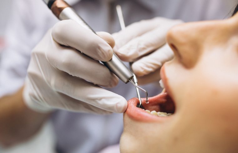 Implante dentário: o que é, como funciona e quais são os benefícios